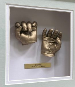hand casts