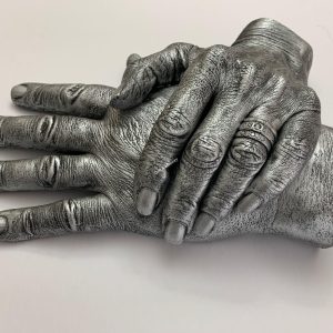 two hands together in cast
